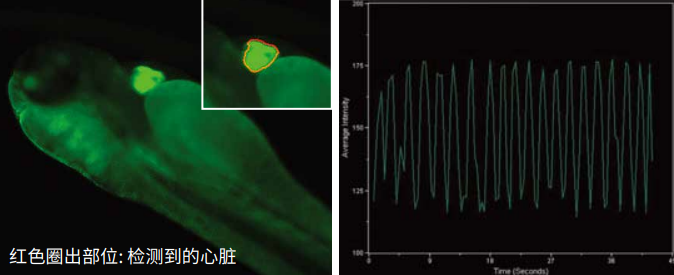 Cardiac function in transgenic zebrafish with cells expressing a GFP-tagged protein