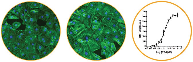 Images of untreated (left) and 10 nM ET-1–induced (middle) iCell Cardiomyocytes