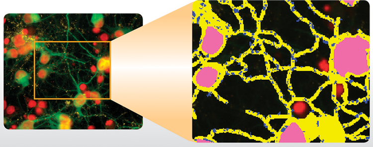Counts puncta in Neurite Outgrowths