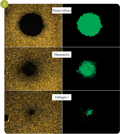 Cell migration custom analysis