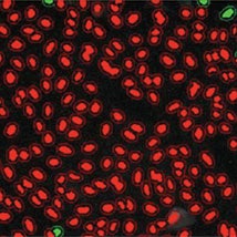 High nuclear translocation