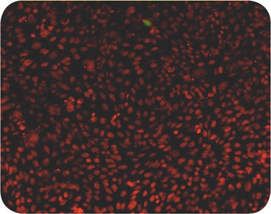 50 µM camptothecin treated cells exhibit high incidence of apoptotic nuclei
