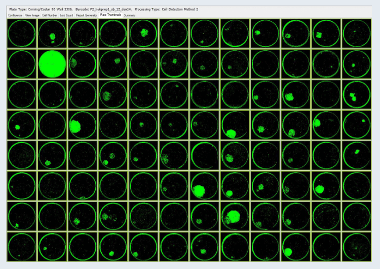 CSI-FL Day 14 colony images of HEK-293s