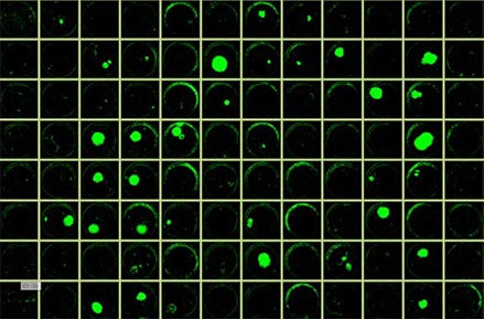 Whole well images on Day 10 generated by the CSI FL, showing colonies in green.