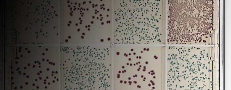 Microbial Research