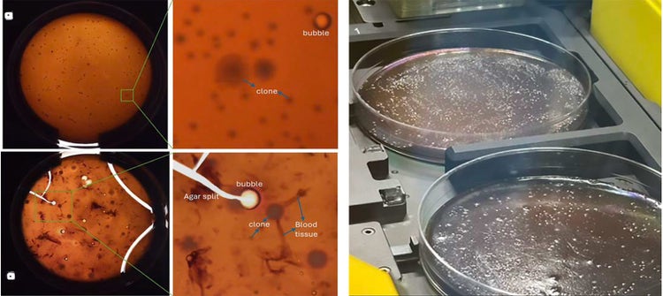 Bacterial colonies from a stool sample grown on blood agar after anaerobic incubation