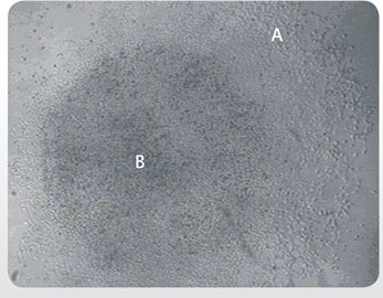 Differentiated and undifferentiated CGR8 meS cells