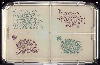 Source culture of E. coli (blue) and Klebsiella(pink) plated on 4-well OmniTray containing ECC CHROMagar