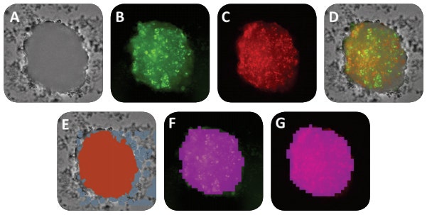 Images of a FUCCI spheroid