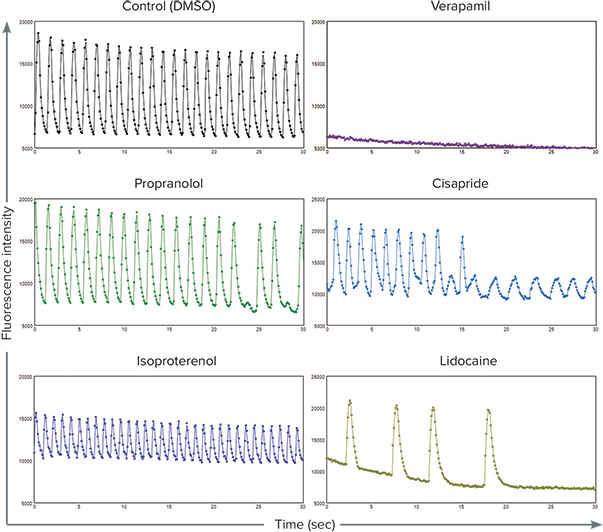 Cardiomyocyte spheroid beat patterns
