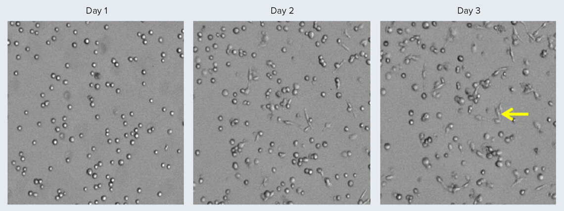 Quantify TNFa secretion by THP-1-derived macrophages with an