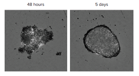 spheroids-imaged-in-the-tl-channel