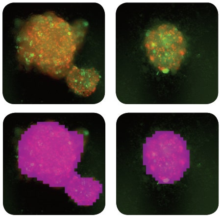 Images of FUCCI spheroids in different sizes and shapes