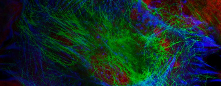 Bright-Dtech nanoparticles