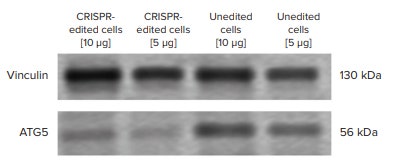ATG5 western blot experiment