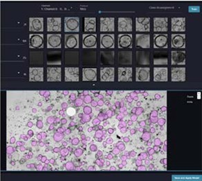 Organoid classification using ML Phenoglyphs module for organoid