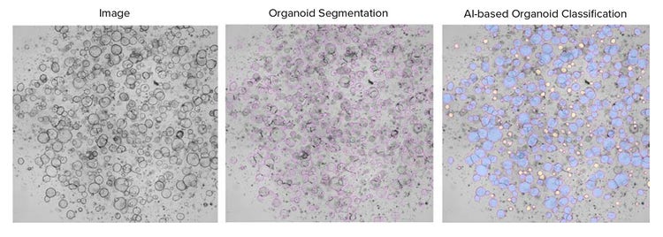 AI-based classification of Human Intestinal Organoids