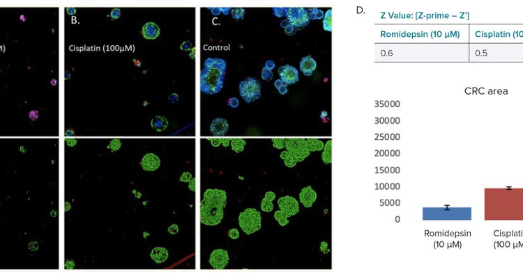 CRC organoids’ confocal images