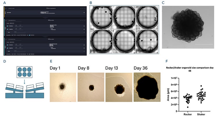 Differentiation of human iPSC into brain organoids