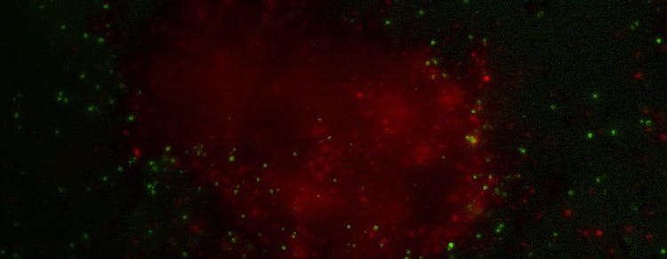 Organoid Workflow for T-cell Screening