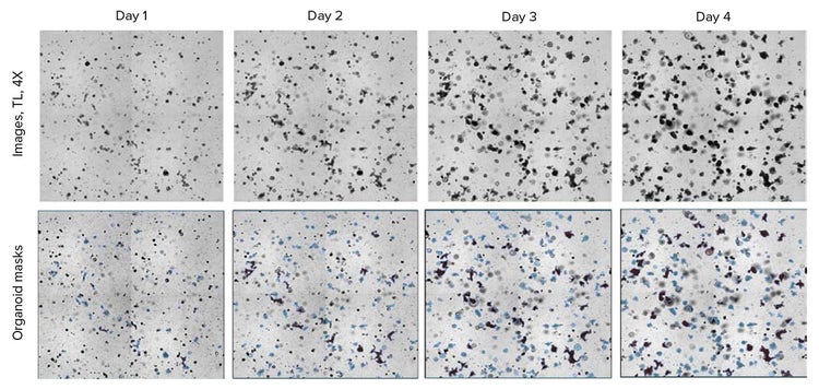 Images show mouse intestinal organoids taken on days 1 to 4, which were segmented/defined using SINAP