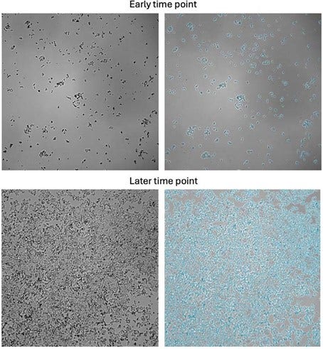 Representative images of HCT-116 cells acquired using CellXpress.ai and analyzed with IN Carta software