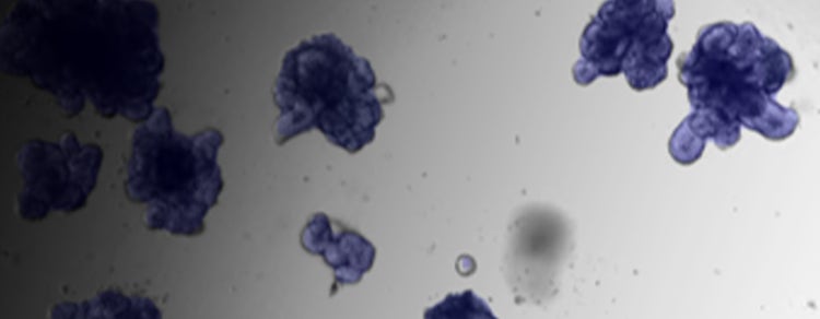 patient-derived organoid (PDO) culture
