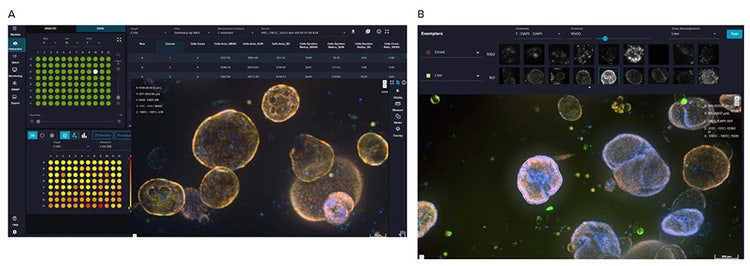 IN Carta software showing data review, feature measurements, and Phenoglyphs module analysis of human intestinal organoids