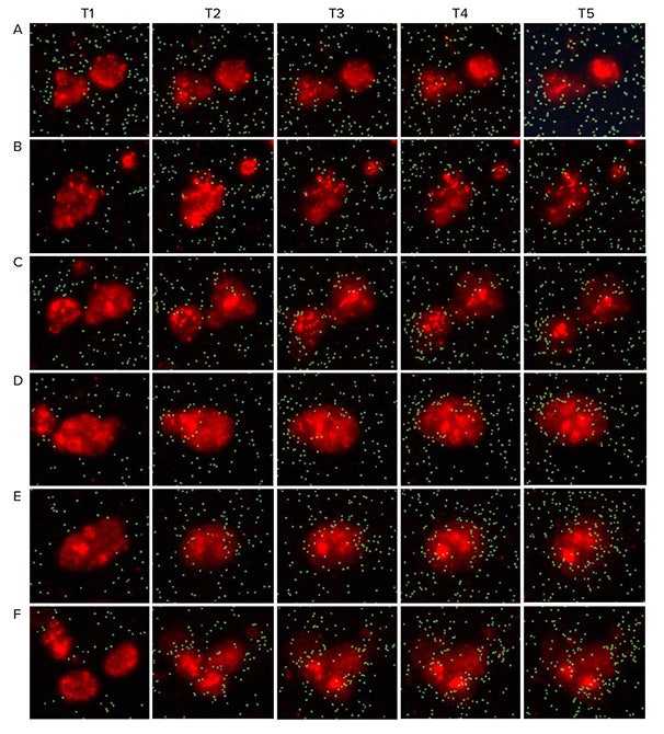 Representative overlays of organoid image and T cell masks for the five time points