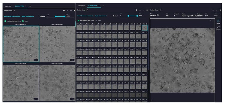 On CellXpress.ai. human intestinal organoids cultured in a 96-well U-bottom plate & imaged using transmitted-light microscopy