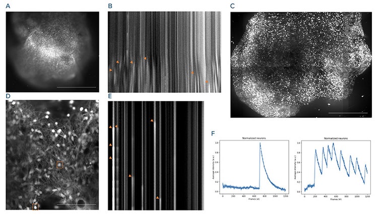 Image acquisition and analysis acquisition of calcium-stained brain organoid