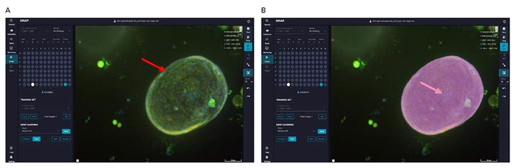 Image showing steps for deep learning segmentation models training