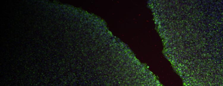 Automated iPSC culture