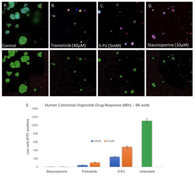CRC organoids’ control and treated confocal images