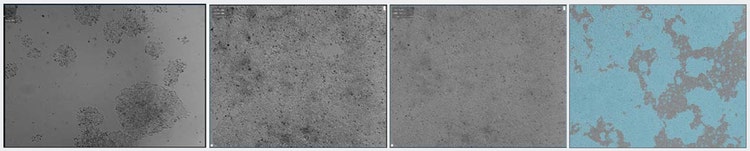 HCT116 cells with low or high confluency