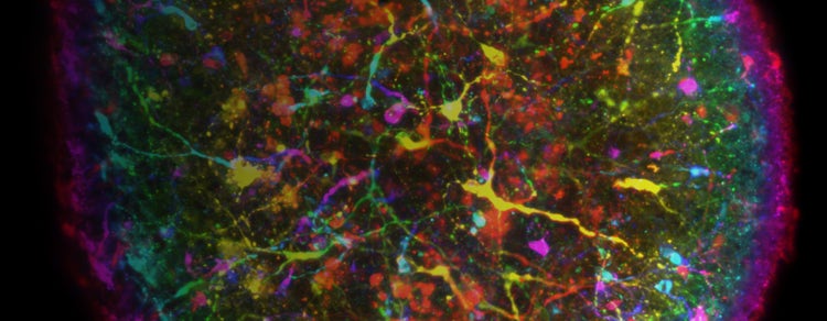 Tech note on Brain Organoids