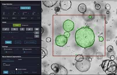 Organoid segmentation using deep-learning from the SINAP module in IN Carta