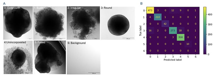 Representative images of classes used for organoid classification