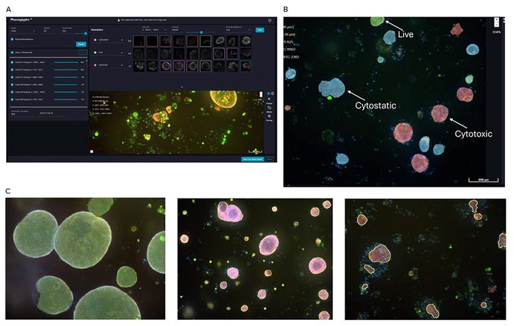 Phenoglyphs module of intestinal organoids as live (green), cytostatic (blue, pink), or cytotoxic (red) with representative images