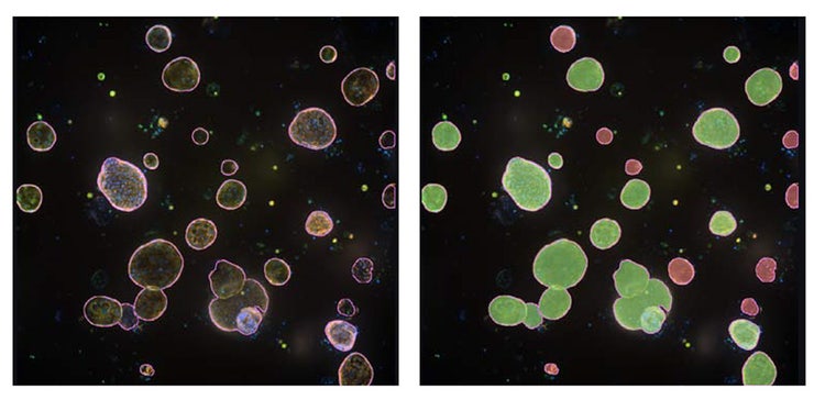 Phenoglyphs module human intestinal organoids in (green masks) or damaged (red masks) using extraction and model refinement