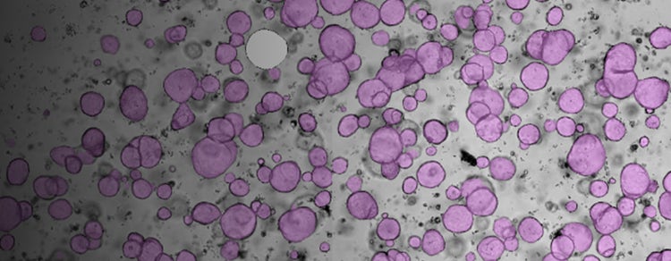 3D Organoid Culture