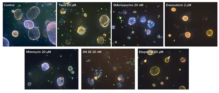Representative maximum projection images captured on ImageXpress HCS.ai system using the standard confocal option (60 μm pinhole) at 10X magnification