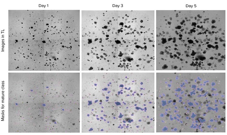 AI-based classification of human colorectal organoids