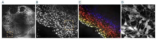 High-resolution image acquisition of brain organoids