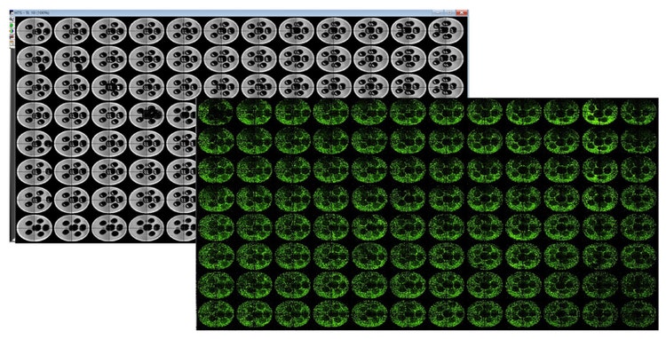 TL image of 3D printed pluronic pillar arrays