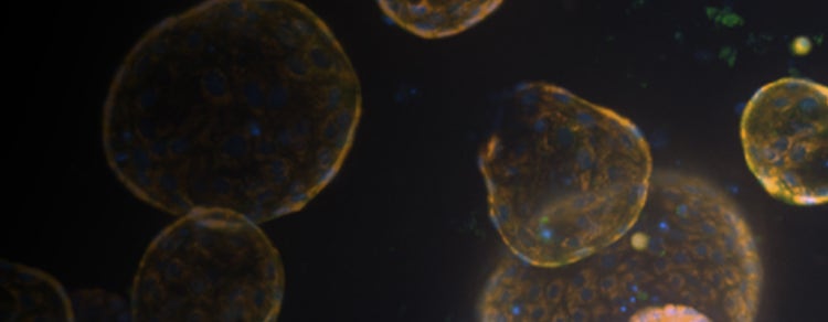 Human Intestinal Organoids