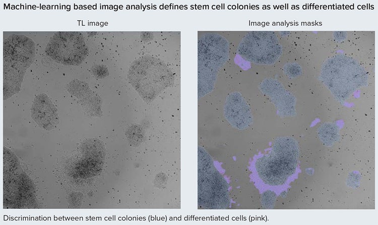 Pre-trained analysis models define stem cell colonies (in blue) and differentiated cell patches (in pink).