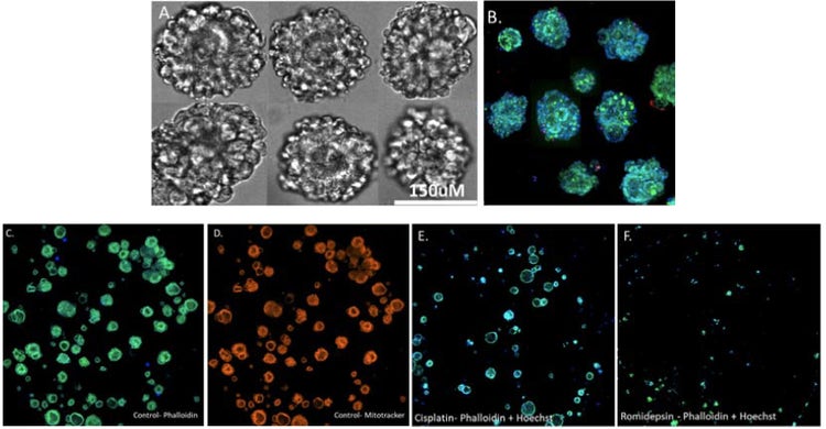 Images of CRC organoids on day seven in transmitted light