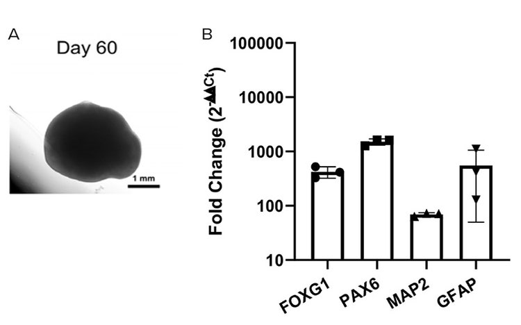 Representative brightfield morphology of a day 60 dorsal forebrain organoids