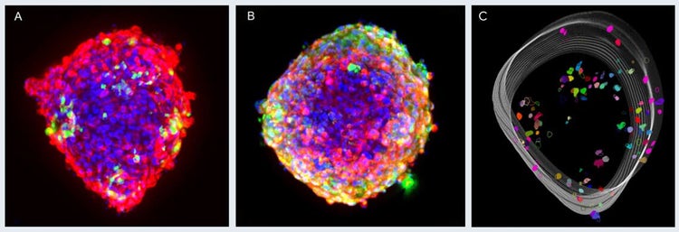 Composite images of cardiac tri-culture microtissues